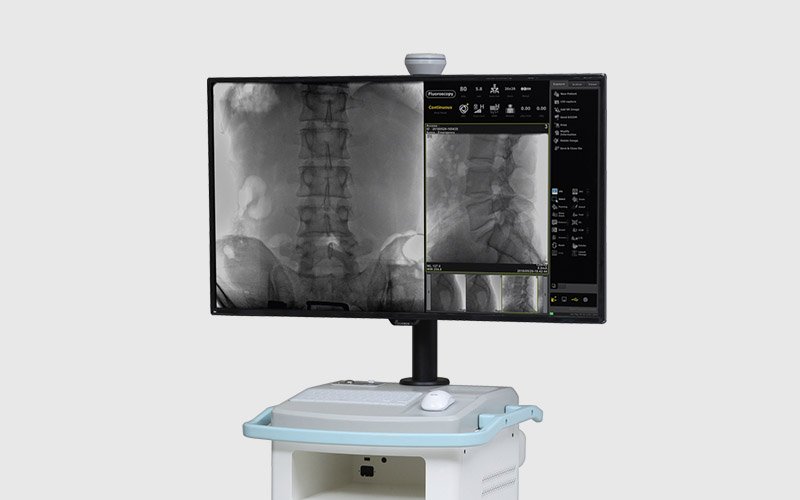 C-Arm Monitors