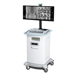 Genoray Oscar Classic C-Arm Monitor Cart