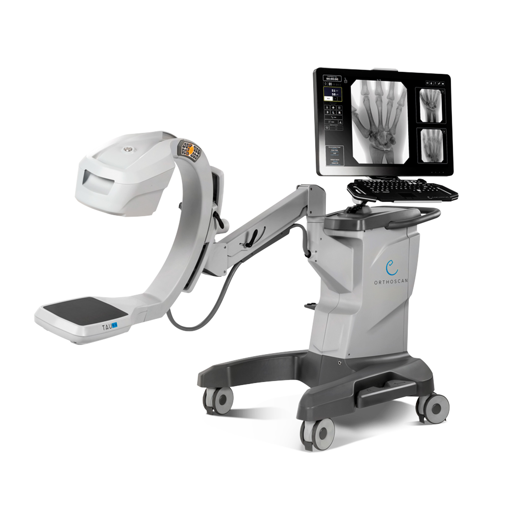 Orthoscan Tau 1512 C-Arm